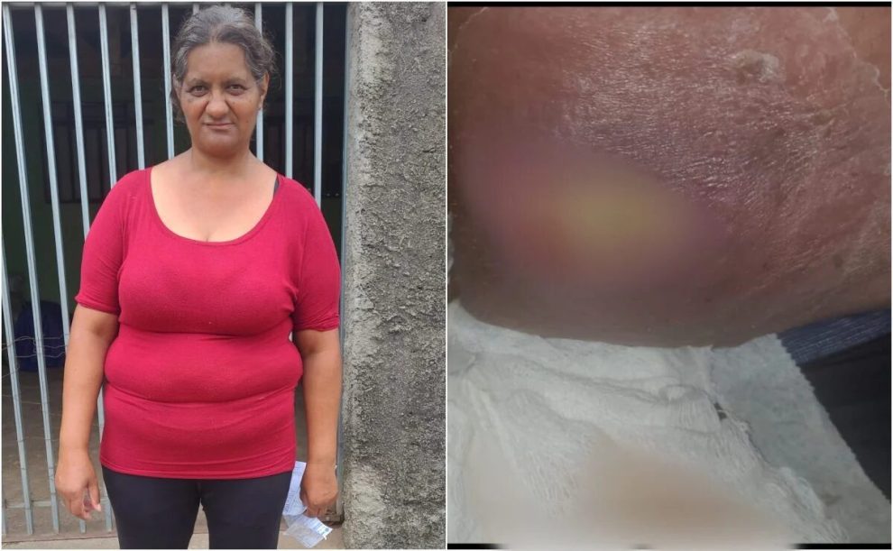 'Dor intensa e dificuldade para caminhar'