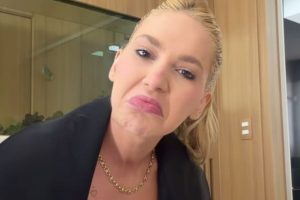 Virgínia Fonseca Inicia Tratamento Após Novo Diagnóstico de Alopecia e Expõe Efeitos do Estresse