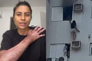 Advogada que sobreviveu a incêndio em apartamento critica resgate e atuação de bombeiros: ‘Fui queimada viva’