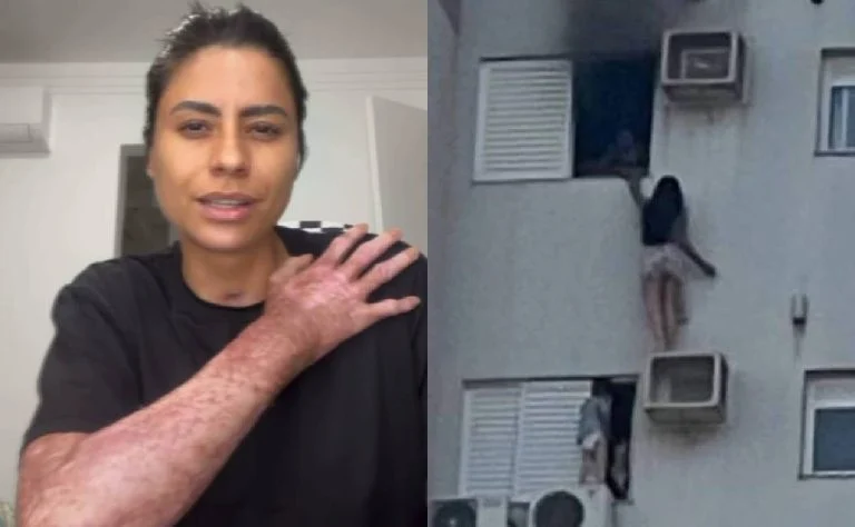 Advogada que sobreviveu a incêndio em apartamento critica resgate e atuação de bombeiros: ‘Fui queimada viva’